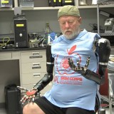 Amputee Makes History with APL’s Modular Prosthetic Limb
