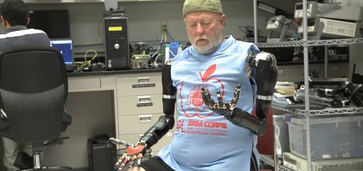 Amputee Makes History with APL’s Modular Prosthetic Limb